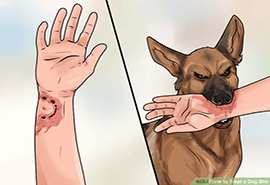 ​Animals Bites Treatment   