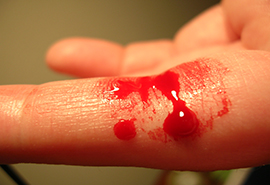  Health Tip: Control a Bleeding Wound